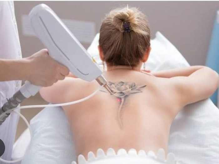 IPL Photo Facial
